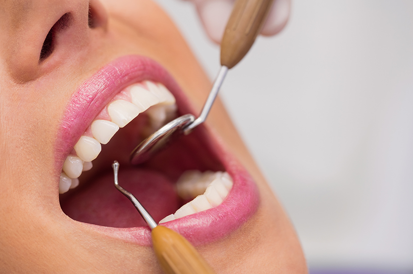 Dental Scaling and Polishing Process: A Step-by-Step Guide to Sparkling Smiles